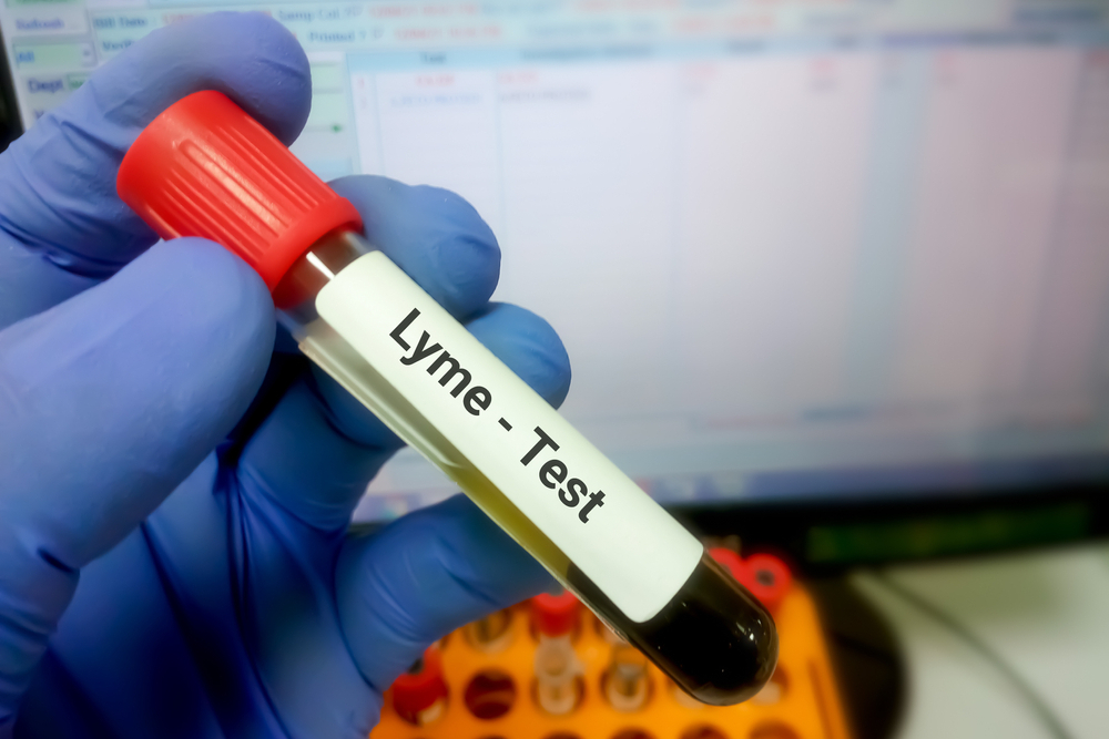 Lyme disease testing, highlighting tick-borne disease screening, early detection, diagnosis, and preventive veterinary care.